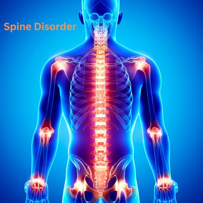 Spine Disorder