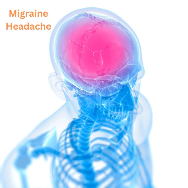 Migraine Headache Treatment